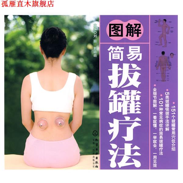 【正版书】 图解简易拔罐疗法 郭萌萌 化学工业出版社