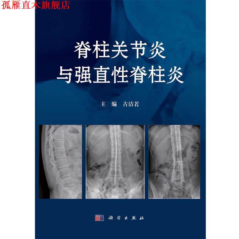 【正版书】 脊柱关节炎与强直性脊柱炎 古洁若 科学出版社