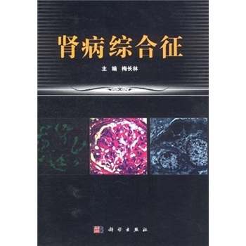 肾病综合征