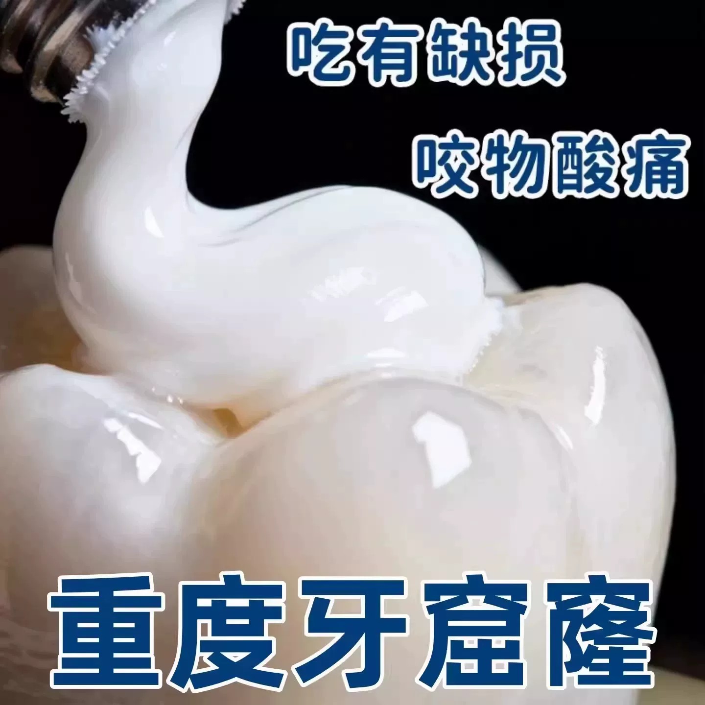 【严重牙窟窿】牙齿有洞蛀牙智齿吃肉塞牙牙膏正品 老少通用