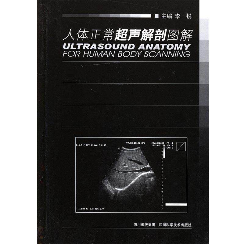【正版书】 人体正常超声解剖图解 李锐 主编 四川科技出版社