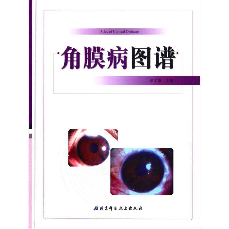【正版书】 角膜病图谱 张文华 北京科学技术出版社