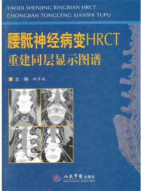 【正版】腰骶神经病变HRCT重建同层显示图谱 林井副；林井副