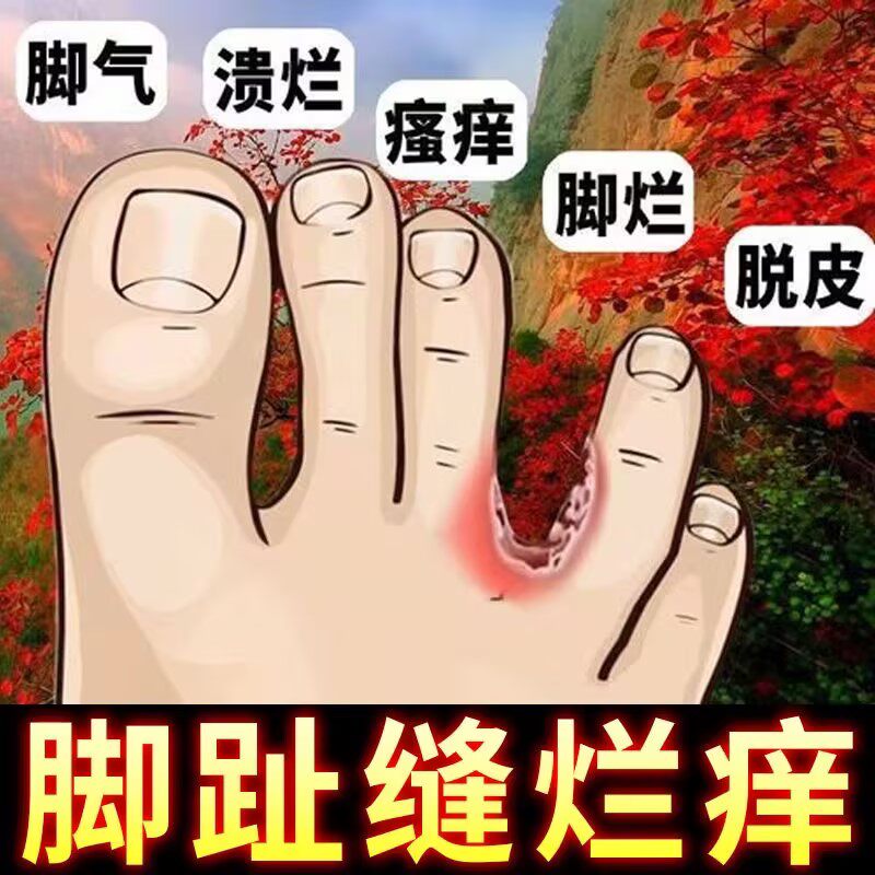 脚臭泡脚药包脚气止痒脱皮杀菌除烂脚丫足光粉去死皮真菌水泡中药