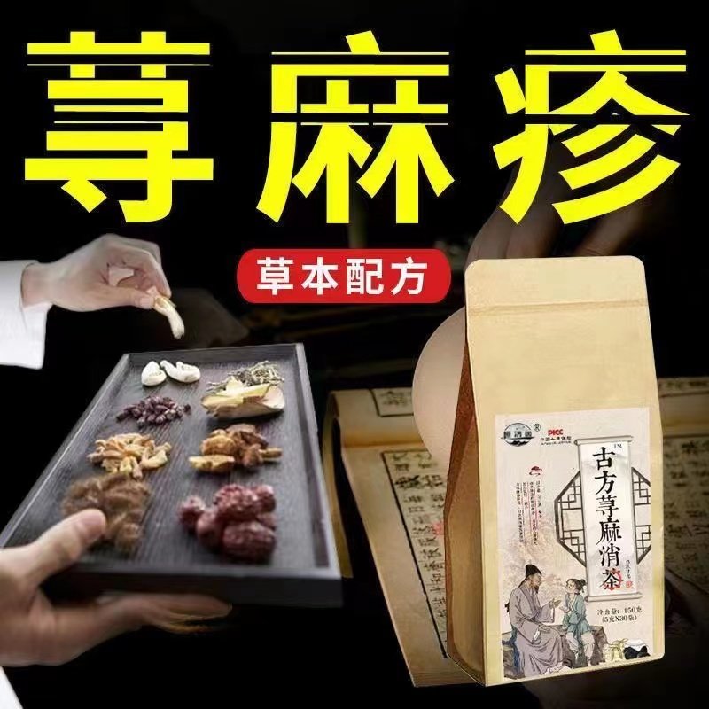 古方荨麻消茶麻疹过敏止痒断专用胆皮肤瘙痒丘疹型寻麻疹药