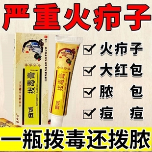 断痒拔毒膏皮脂腺囊肿火疖子膏药去粉囊肿脓贴长痘坐疮神正品