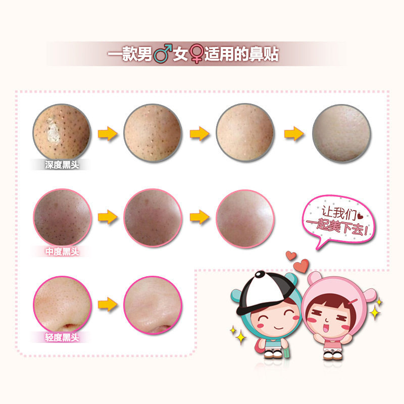 泊泉雅猪鼻子去黑头三部曲鼻贴鼻膜吸白头粉T区刺收细毛孔