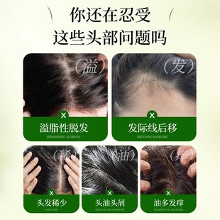 北京同仁堂侧柏叶何首乌洗发粉生B姜洗头水养发护发官方店正品官