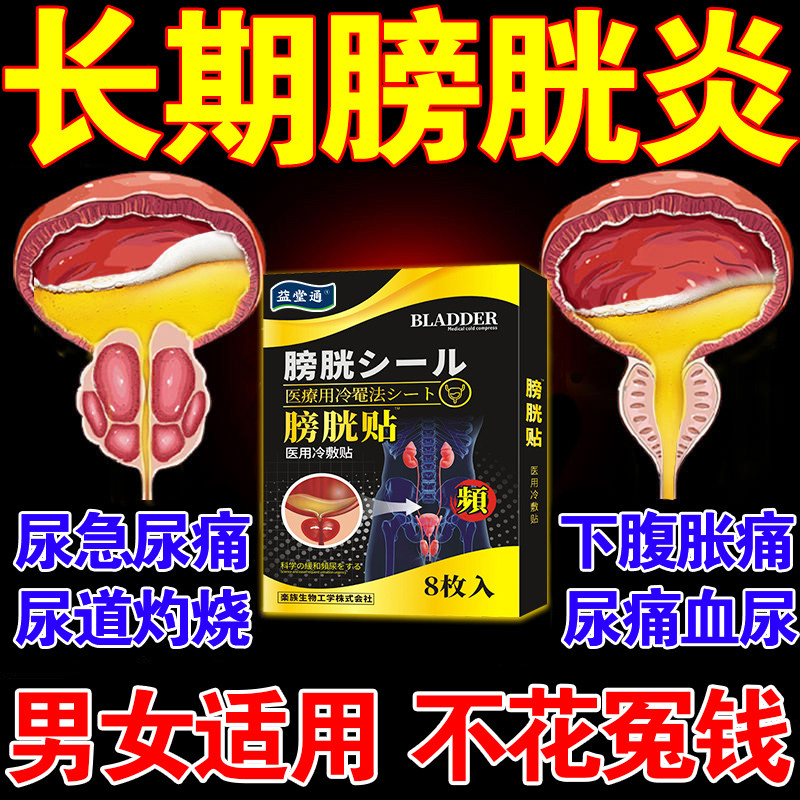膀胱炎专用膏药贴尿道炎女男尿路感染治疗尿频尿不尽尿无力专用贴