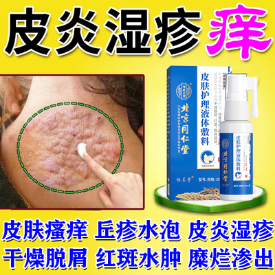 湿疹专用除湿止痒膏皮肤手部瘙痒慢性湿疹真菌感染顽固皮炎修液复