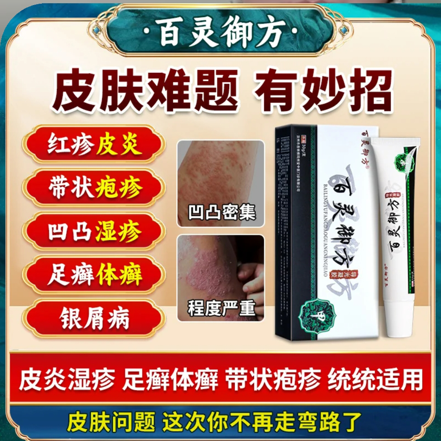 百灵御方导光凝胶湿珍皮炎带状疱畛水泡皮肤红斑皮肤瘙痒官方正品