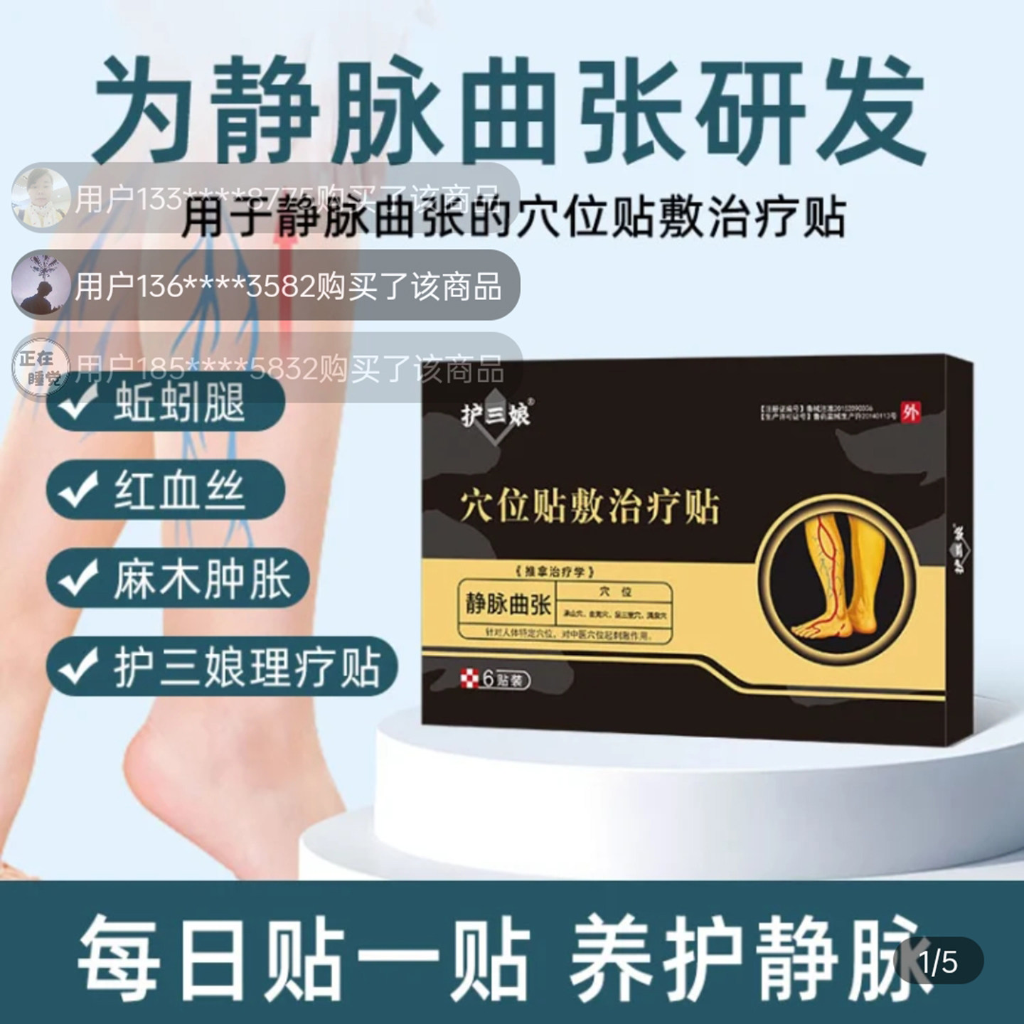 护三娘静脉曲张穴位贴血管肿胀蚯蚓样腿青筋凸起红血丝下肢酸麻木