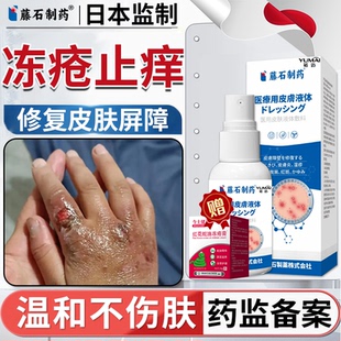 冻疮膏止痒冻伤膏正品防冻裂耳朵儿童成人修复专用脸部特效医用VV