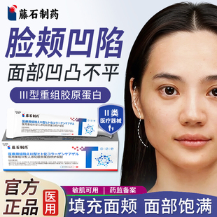 填充脸颊凹陷神器医用重组三型人源化胶原蛋白填充面部凹陷脸部KD