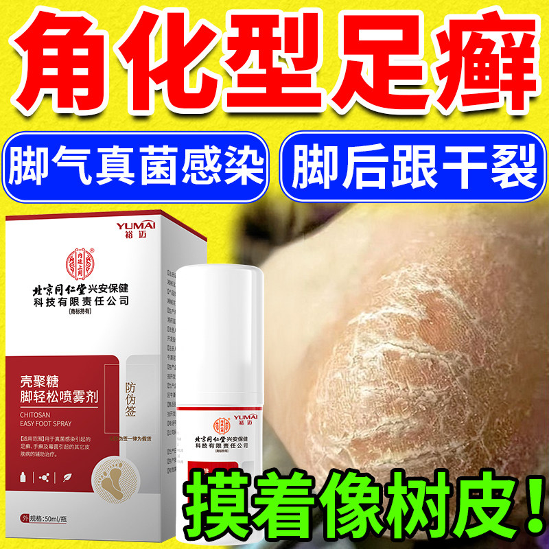 脚后跟干裂起硬皮足跟开裂真菌感染角化型脚气喷雾专用一癣次净KD