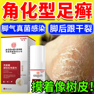 脚后跟干裂起硬皮足跟开裂真菌感染角化型脚气喷雾专用一癣次净KD