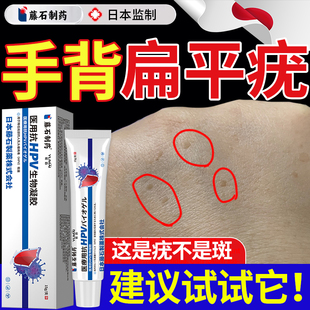 手背扁平疣专用搭膏药贴去除膏一去疣抹灵丝状神器干扰素b2凝胶KD