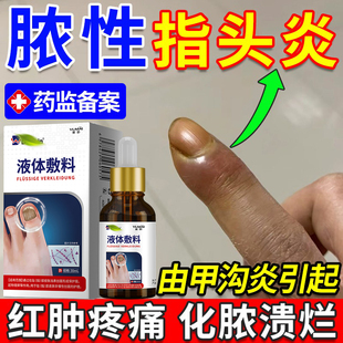 脓性指头炎手指化脓手指甲真菌感染药监备案甲沟炎消肿化脓KD
