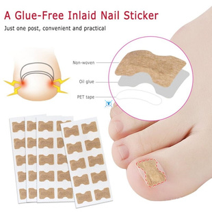 10/20PCS Ingrown Toenail Correction Stickers Glue Free Ing