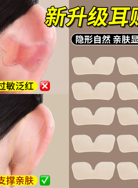 新升级5D精灵耳贴耳朵强支撑器隐形亲肤立耳贴显脸小招风耳定型贴