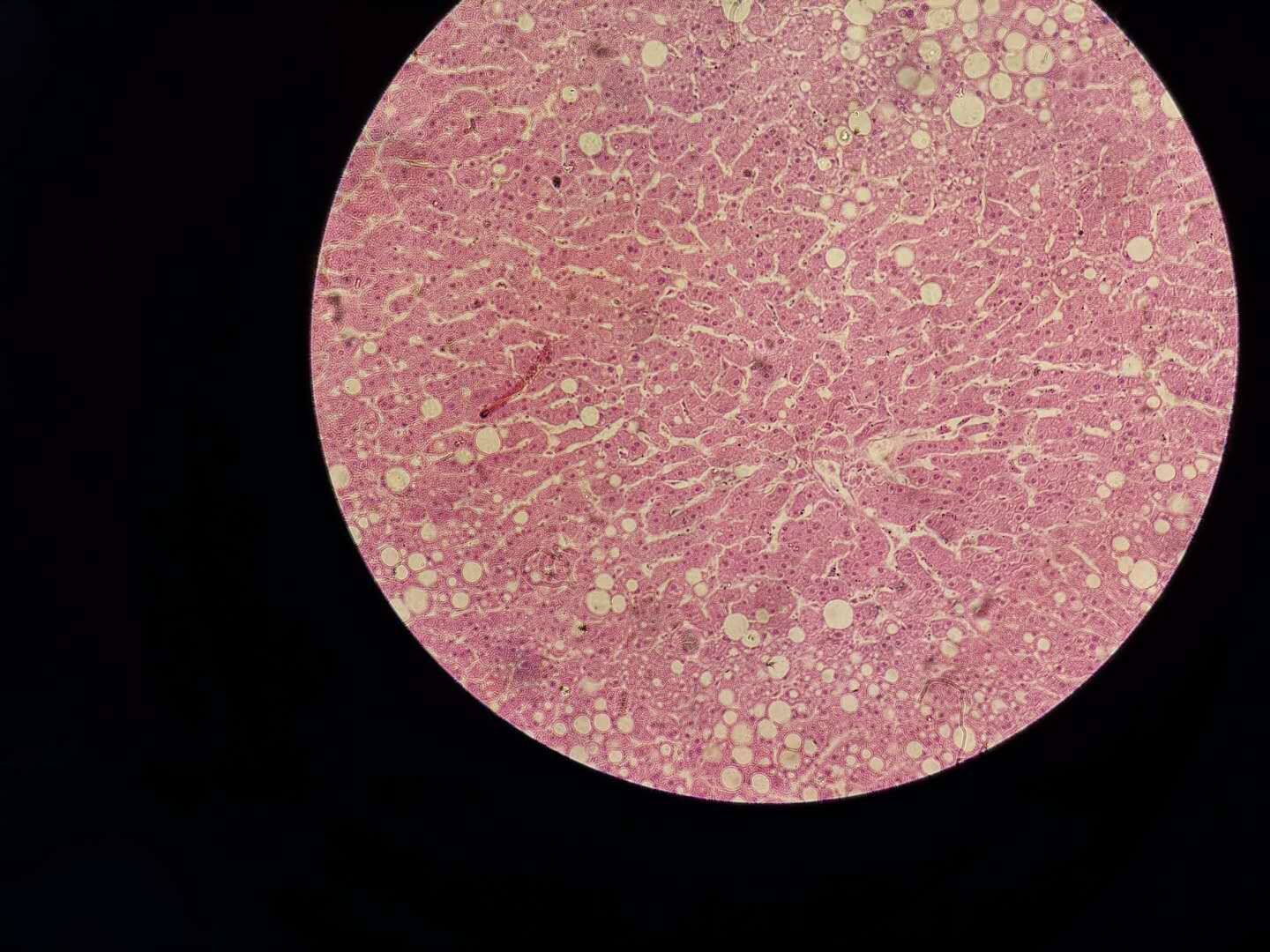 肝脂肪变性切片 细胞组织损伤及修复动物病理学教学生物玻片标