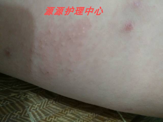 癣痒偏方药膏治疗牛皮癣银屑病皮肤瘙痒外用特效断根藓药 优库淘