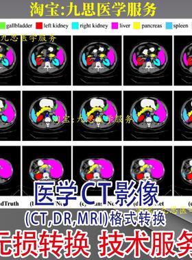 医学图像(CT,DR,MRI)格式转换 可将医院拷贝的DICOM无损转JPG格式
