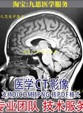 医学CT影像 dicom转图片 二维码云影像导出转dicom 图片转PDF格式