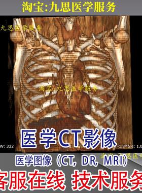 医学CT影像Dicom文件dcm格式牙科片CD CT批量转换图片PNG格式JPG