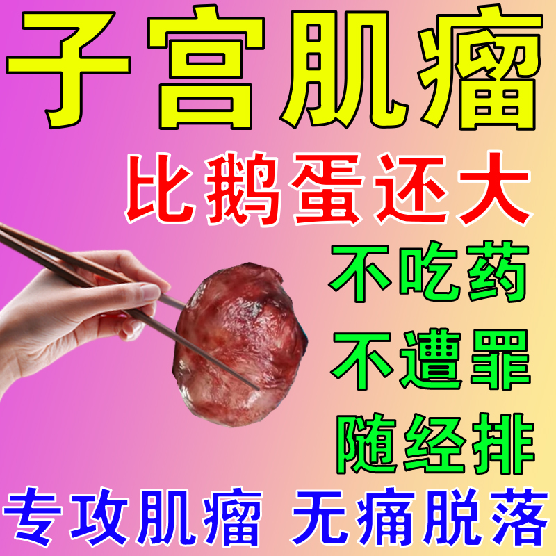 子宫肌瘤中药贴调理妇科炎症月经不调豆腐渣白带异味卵巢囊肿腺肌