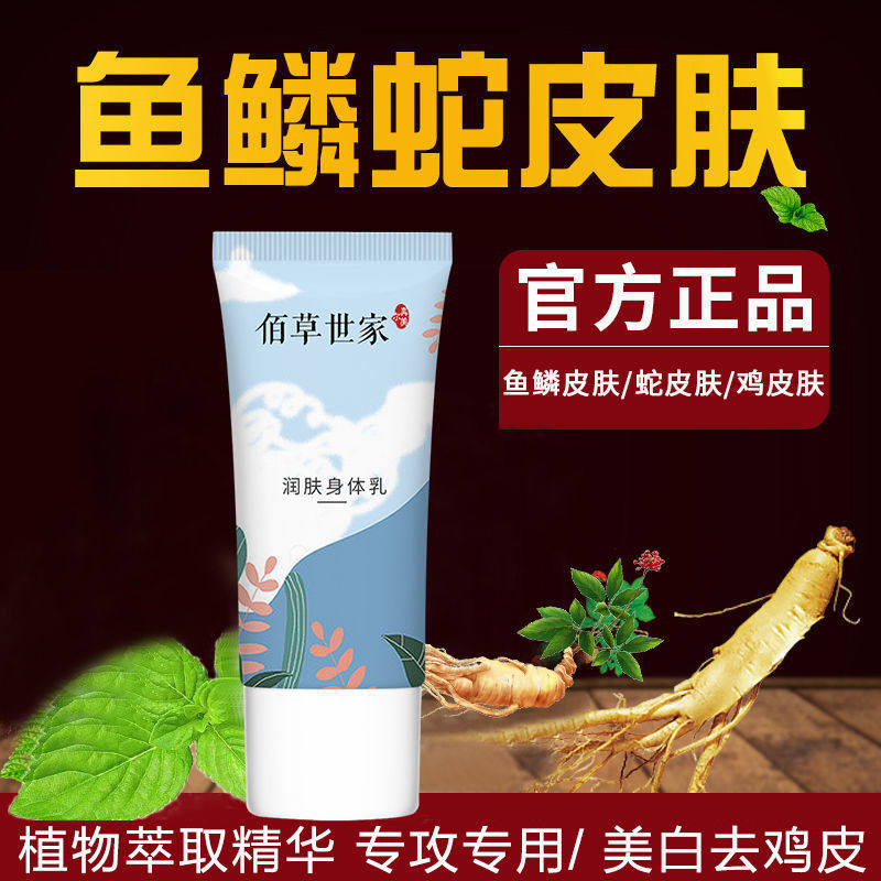 去鱼鳞皮肤霜 皮肤干燥起皮治鸡皮肤身体乳腿上粗糙腿部
