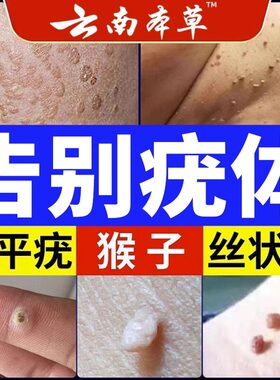 云南本草脖子丝状尤扁平嘧啶克尤