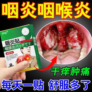 支气管炎止咳清肺化痰贴咳嗽药胸闷气短急慢性支气管咳喘中药贴Z