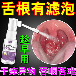 舌根淋巴滤泡增生慢性咽炎咽后壁咽喉扁桃体发炎异物感长泡喷剂Z