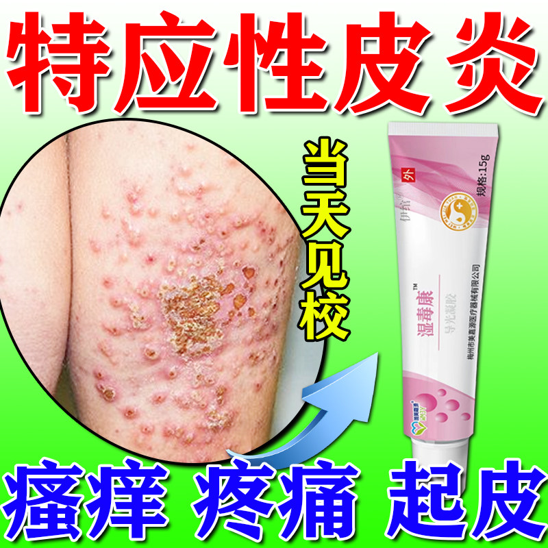 医用级更放心】儿童特应性皮炎