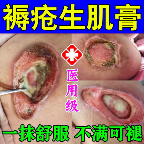 褥专疮膏老人卧床久躺臀部外用神器伤口不愈合促进长肉压疮屁股Z