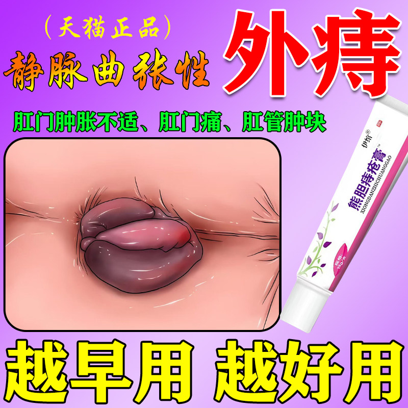 静脉曲张性外痔凝胶消肉球痔疮药膏排行榜第一名官方旗舰店效特膏