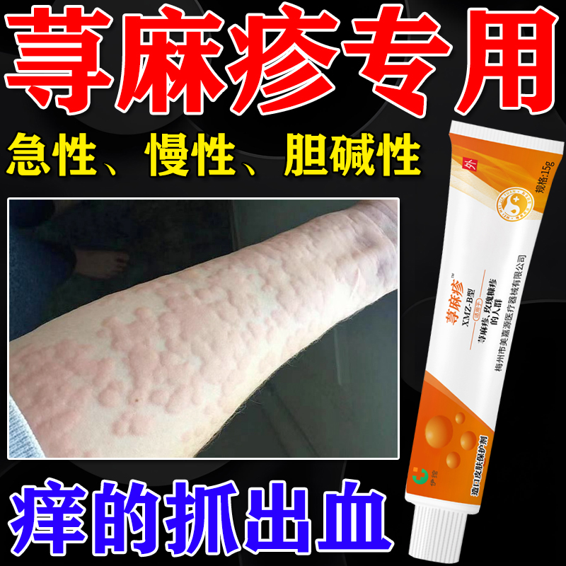 早用早好】寻荨麻疹过敏止痒用专