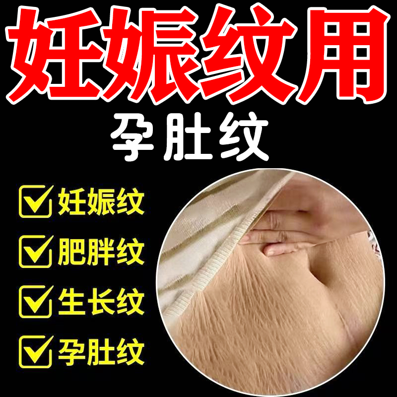 孕肚纹】妊娠纹修复膏