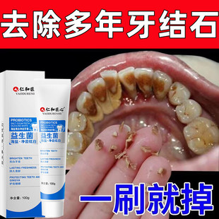 仁和美白牙膏去黄去除器溶解牙石减轻烟渍垢牙结石洗去口臭男士女