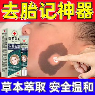 胎记去除神器脸部黑色素青红太田咖啡斑淡化分解胎记天生去胎记膏