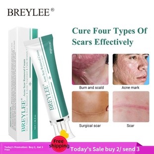 BREYLEE Remove scars Pregnant woman Stretch marks Care cream