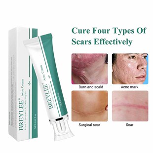 Acne Scar Removal Cream Skin Repair Face Cream 修复膏