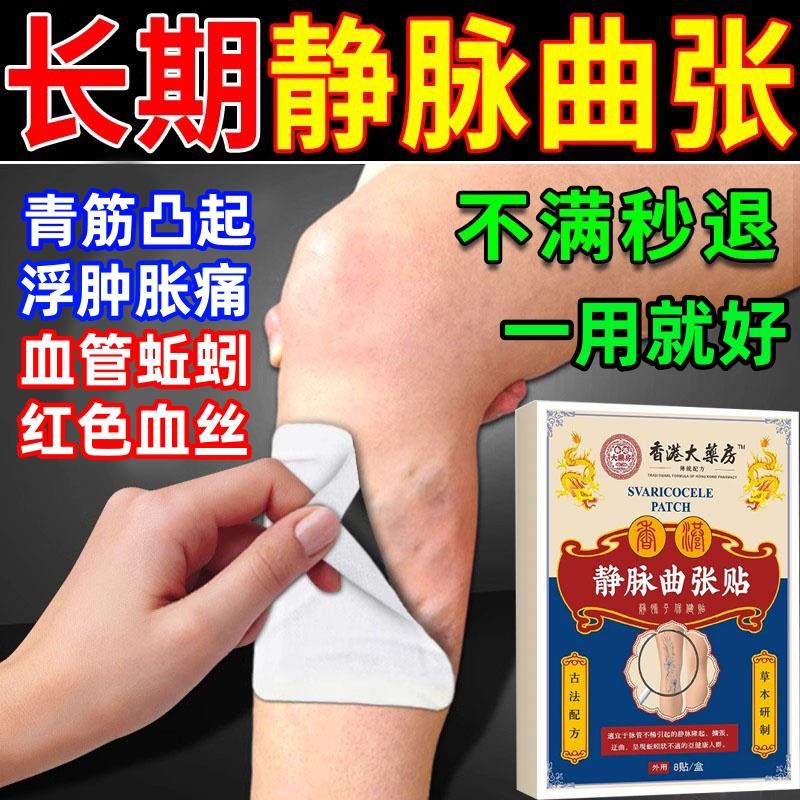 静脉曲张特效专用药膏静脉曲张红血丝贴小腿青筋凸起下肢沉重酸胀