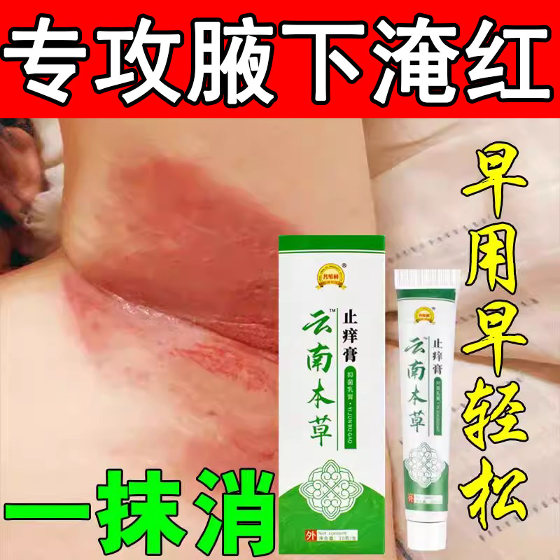 【腋窝湿痒痛】腋下淹红疼痛乳膏