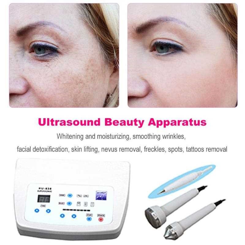 Ultrasons femmes soins de la peau blanchiment des taches de