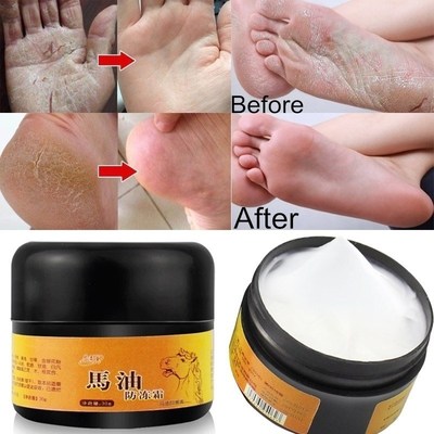 Horse Oil Foot Hand Antifreeze Cream Treatment Dry Skin Heel