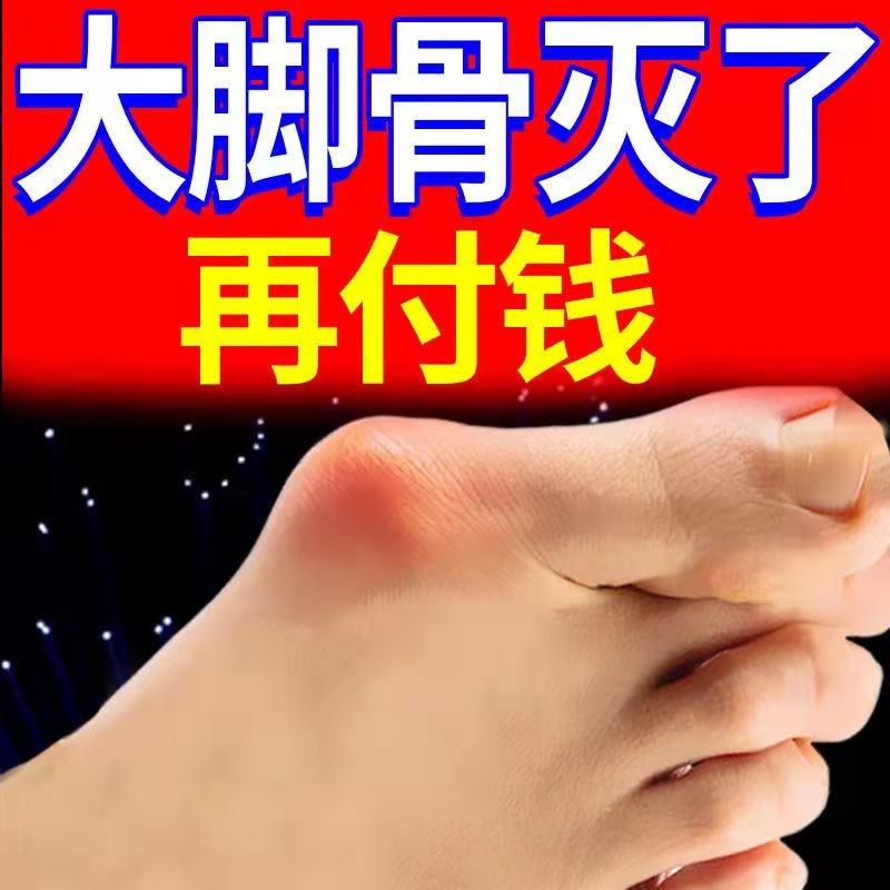 拇囊炎疼痛拇指外翻膏药贴大脚骨外翻脚趾疼痛畸形肿胀矫正专用贴