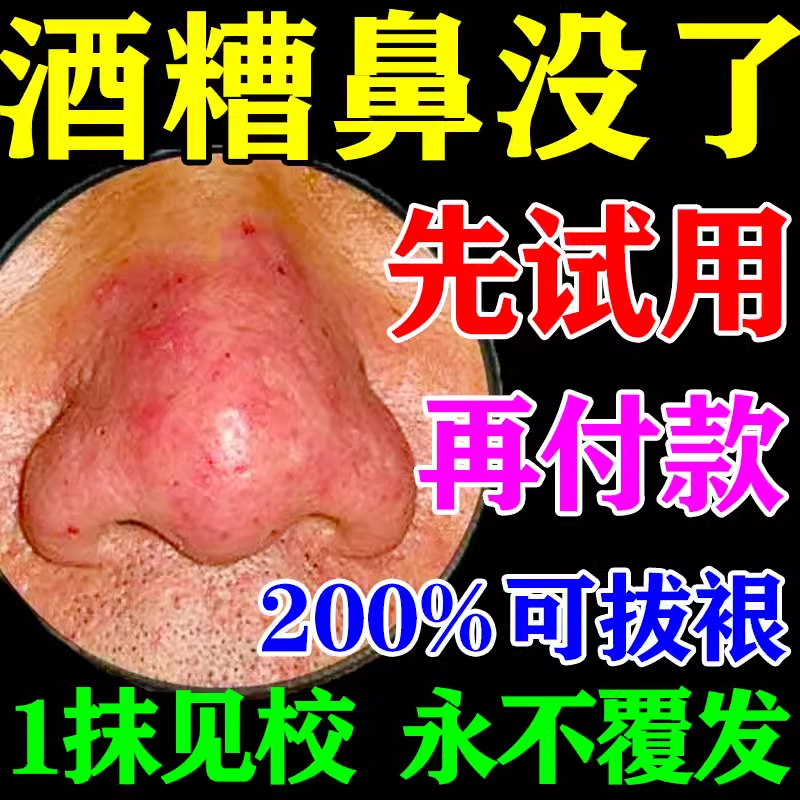 鼻子两侧起皮脱皮发红鼻翼两边泛红干燥修复长痘痘痒膏酒糟鼻
