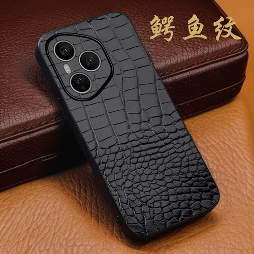 月梵希适用honor/荣耀400鳄鱼上下纹honor/荣耀400pro真皮honor/高档防摔荣耀200荣耀GT新款全包手机壳